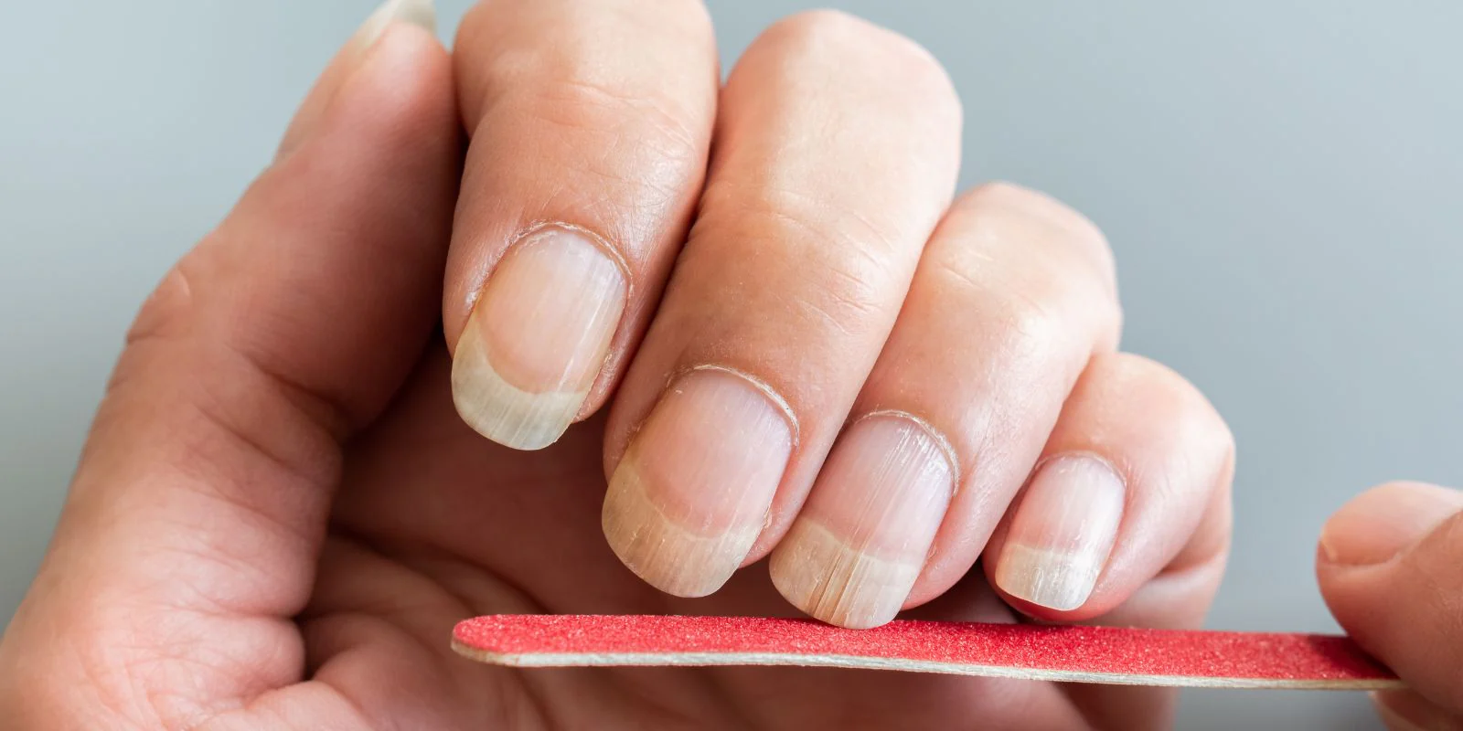 längsrillen fingernägel leber